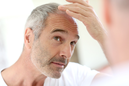 Hair loss in men and women